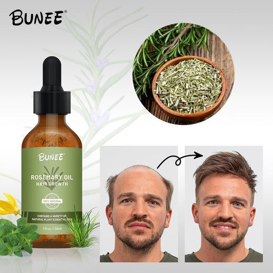 BUNEE Rosemary Hair Growth Serum Oil 30 ML(Pack of 2/3) - Cheap bazar